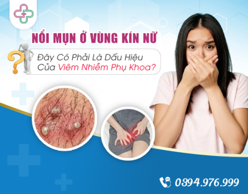 Nổi Mụn Mủ Ở Vùng Kín Nữ Giới - Đây Có Phải Là Dấu Hiệu Của Viêm Nhiễm Phụ Khoa?