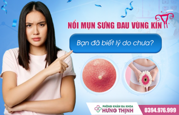 Nổi Mụn Sưng Đau Ở Vùng Kín: Bạn Đã Biết Lý Do Dẫn Đến Tình Trạng Này Chưa?