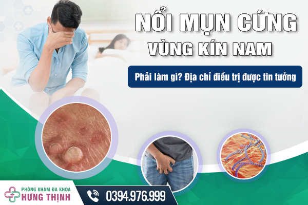 Nổi mụn cứng vùng kín nam giới phải làm gì? Địa chỉ điều trị được tin tưởng