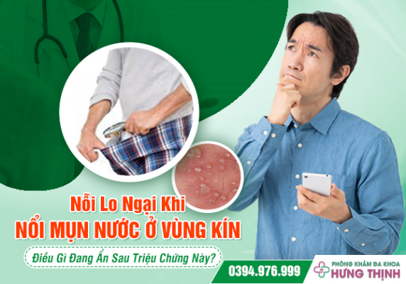 Nỗi Lo Ngại Khi Nổi Mụn Nước Ở Vùng Kín: Điều Gì Đang Ẩn Sau Triệu Chứng Này?