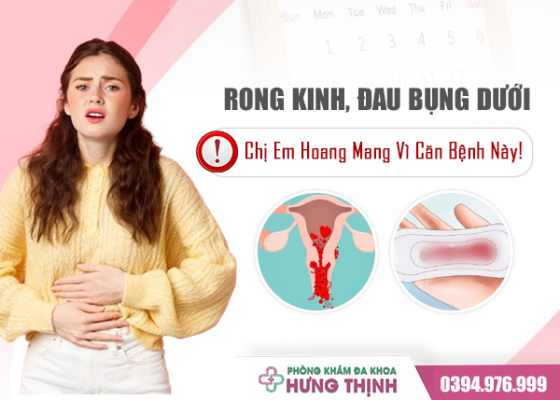 Rong Kinh, Đau Bụng Dưới: Chị Em Hoang Mang Vì Căn Bệnh Này!