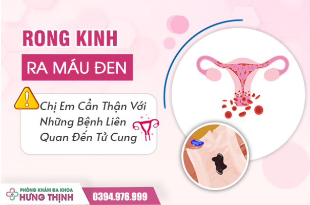 Rong Kinh Ra Máu Đen: Chị Em Cẩn Thận Với Những Bệnh Liên Quan Đến Tử Cung