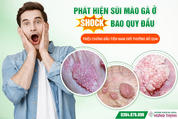 [SHOCK] Phát hiện sùi mào gà ở bao quy đầu – Triệu chứng đầu tiên nam giới thường bỏ qua!