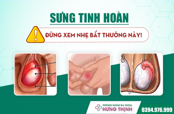 Sưng Tinh Hoàn - Đừng Xem Nhẹ Bất Thường Này!