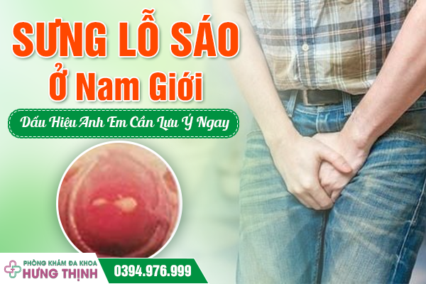 Sưng Lỗ Sáo Ở Nam Giới: Dấu Hiệu Anh Em Cần Lưu Ý Ngay
