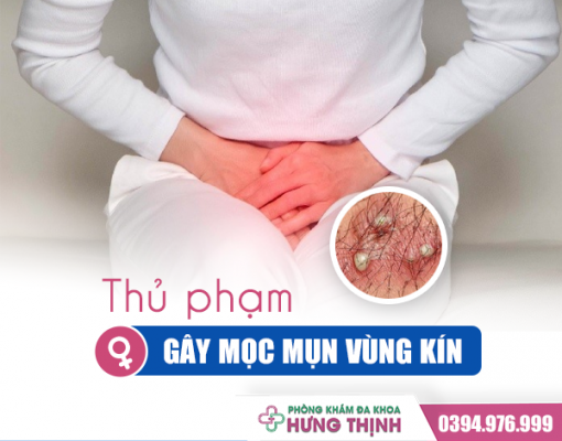 Truy Tìm Thủ Phạm Gây Ra Tình Trạng Mọc Mụn Ở Vùng Kín Nữ