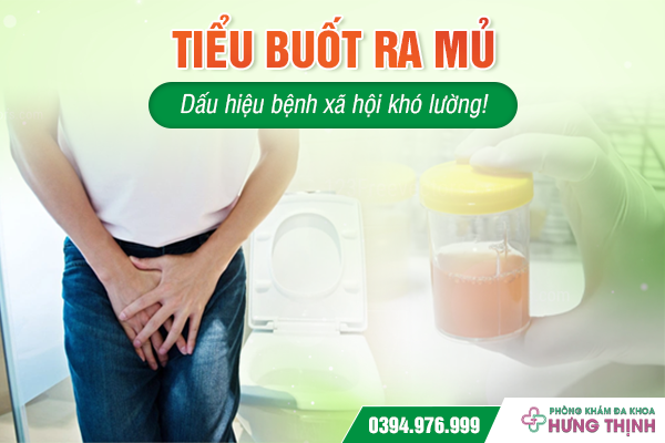 Tiểu buốt ra mủ: Dấu hiệu bệnh xã hội khó lường! 