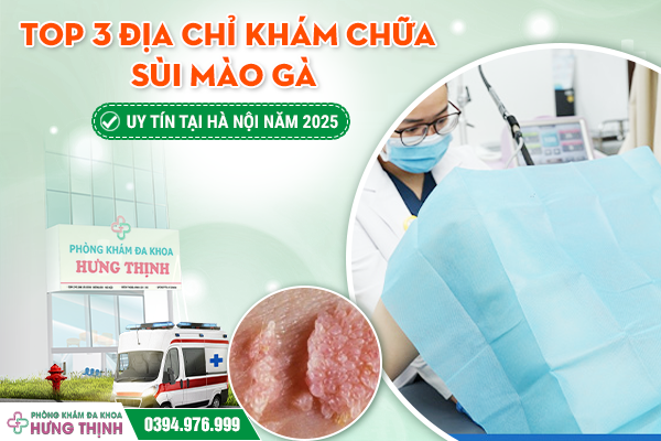Top 3 Địa Chỉ Khám Chữa Sùi Mào Gà Uy Tín Tại Hà Nội Năm 2025