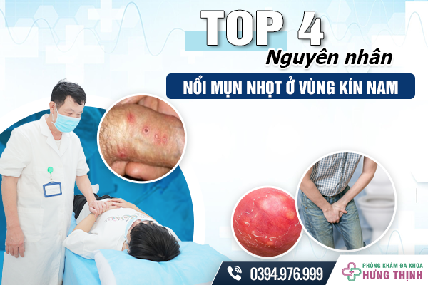 Top 4 nguyên nhân nổi mụn nhọt ở vùng kín nam giới ít ngờ tới