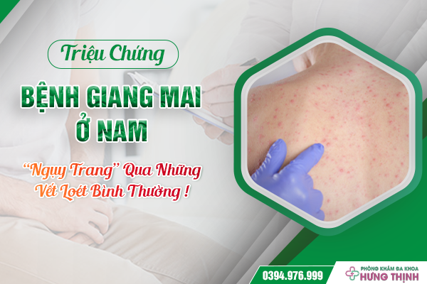 Triệu Chứng Bệnh Giang Mai Ở Nam: “Ngụy Trang” Qua Những Vết Loét Bình Thường !