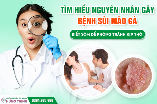 Tìm Hiểu Nguyên Nhân Gây Bệnh Sùi Mào Gà – Biết Sớm Để Phòng Tránh Kịp Thời
