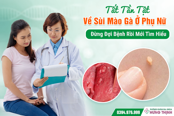 Tất Tần Tật Về Sùi Mào Gà Ở Phụ Nữ – Đừng Đợi Bệnh Rồi Mới Tìm Hiểu