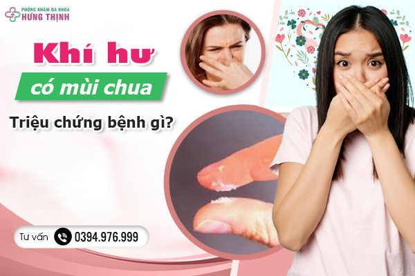 Vén màn bí mật: Khí hư có mùi chua- Triệu chứng bệnh gì? 