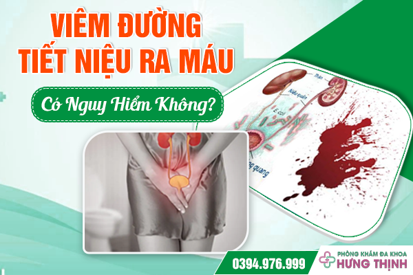 Viêm Đường Tiết Niệu Ra Máu Có Nguy Hiểm Không?