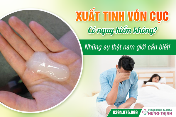 Xuất tinh vón cục có nguy hiểm không? Những sự thật nam giới cần biết!