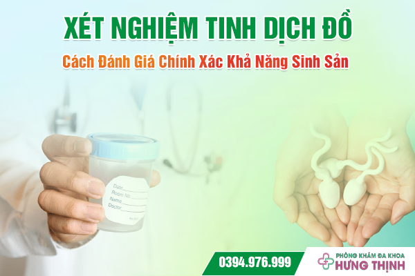 Xét Nghiệm Tinh Dịch Đồ: Cách Đánh Giá Chính Xác Khả Năng Sinh Sản 