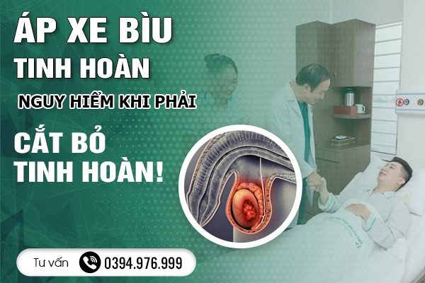 Áp Xe Bìu Tinh Hoàn: Nguy Hiểm Khi Phải Cắt Bỏ Tinh Hoàn!