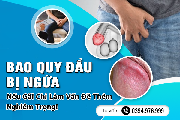 Bao Quy Đầu Bị Ngứa - Nếu Gãi Chỉ Làm Vấn Đề Thêm Nghiêm Trọng!