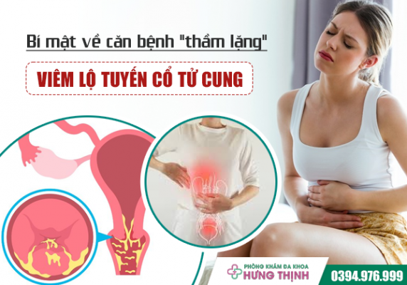 Bí mật về căn bệnh 