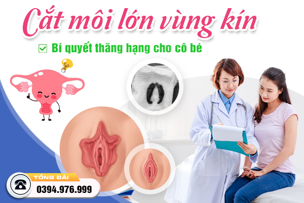 Cắt môi lớn vùng kín - Bí quyết thăng hạng cho cô bé