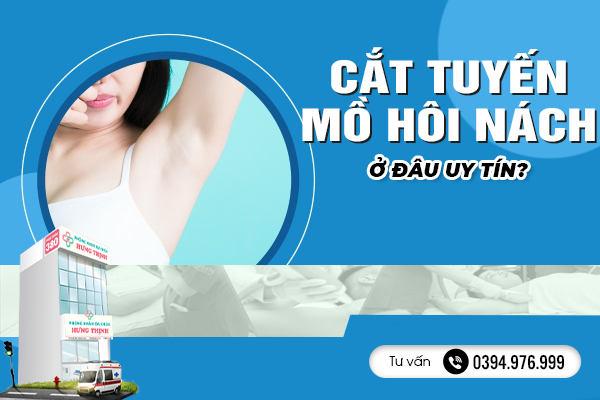 Cắt Tuyến Mồ Hôi Nách Ở Đâu Uy Tín? 