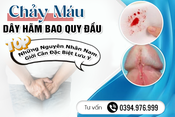 Chảy Máu Dây Hãm Bao Quy Đầu Do Đâu? Top Những Nguyên Nhân Nam Giới Cần Đặc Biệt Lưu Ý