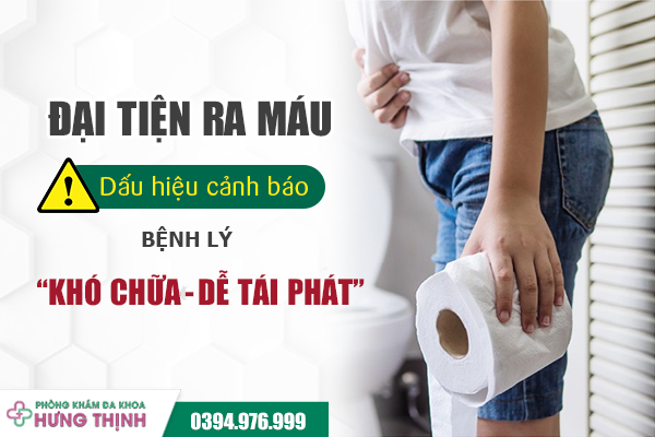 Đại tiện ra máu: Dấu hiệu cảnh báo bệnh lý “khó chữa - dễ tái phát”