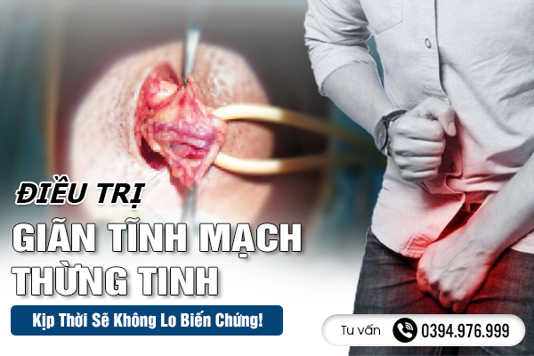 Điều Trị Giãn Tĩnh Mạch Thừng Tinh - Kịp Thời Sẽ Không Lo Biến Chứng!