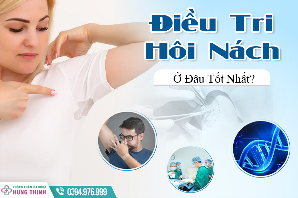 Điều Trị Hôi Nách Ở Đâu Tốt Nhất? - Đừng Bỏ Qua Câu Trả Lời Trong Bài Viết Này!