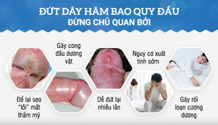 Tiểu phẫu nối dây hãm bao quy đầu - Xóa tan nỗi lo đứt dây hãm bao quy đầu