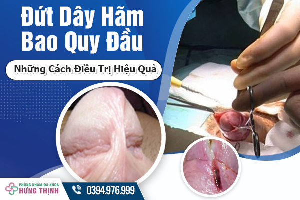 Đứt Dây Hãm Bao Quy Đầu Và Những Cách Điều Trị Hiệu Quả