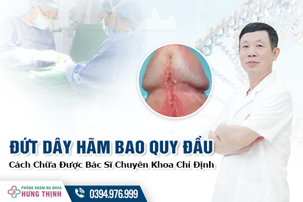 Cách Chữa Đứt Dây Hãm Bao Quy Đầu Được Bác Sĩ Chuyên Khoa Chỉ Định