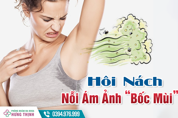 Hôi Nách - Nỗi Ám Ảnh “Bốc Mùi”