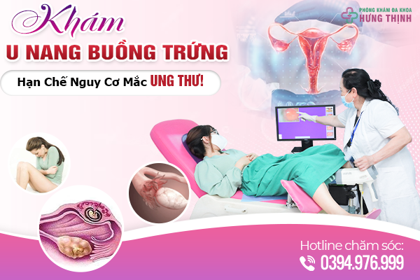 Khám U Nang Buồng Trứng - Hạn Chế Nguy Cơ Mắc Ung Thư!