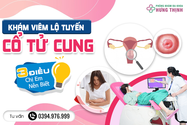 Bật Mí 3 Điều Chị Em Nên Biết Trước Khi Khám Viêm Lộ Tuyến Cổ Tử Cung