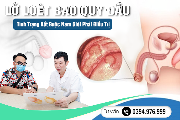 Lở Loét Bao Quy Đầu: Tình Trạng Bắt Buộc Nam Giới Phải Điều Trị