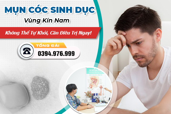 Mụn Cóc Sinh Dục Vùng Kín Nam - Không Thể Tự Khỏi, Cần Điều Trị Ngay!