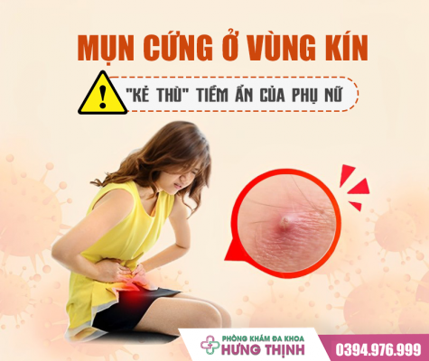 Mụn cứng ở vùng kín - 