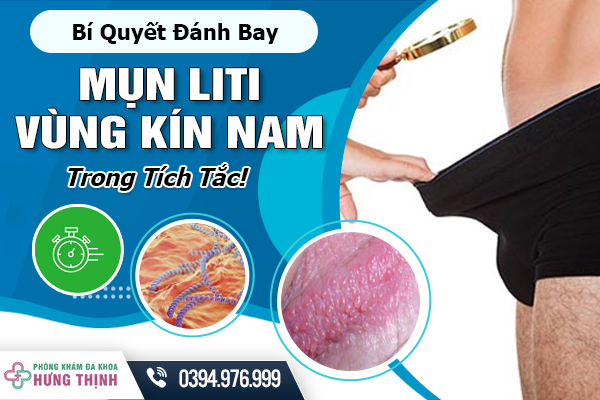 Bí Quyết Đánh Bay Mụn Li Ti Vùng Kín Nam Trong Tích Tắc!