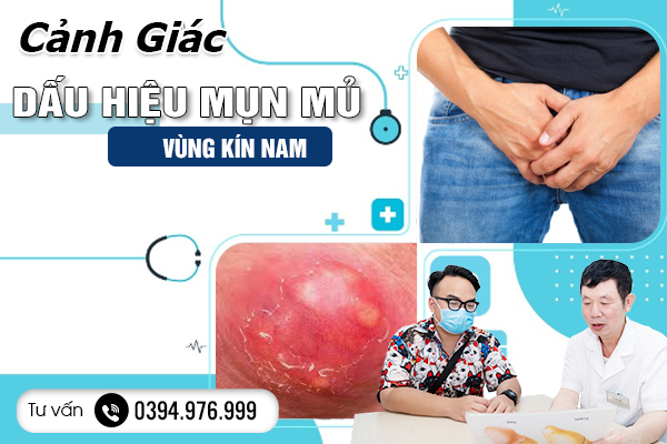 Cảnh Giác Với Dấu Hiệu Mụn Mủ Vùng Kín Nam