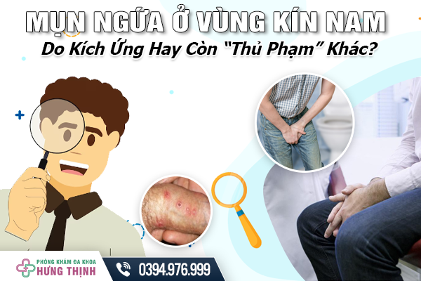 Mụn Ngứa Ở Vùng Kín Nam - Do Kích Ứng Hay Còn “Thủ Phạm” Khác?