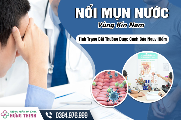 Nổi Mụn Nước Ở Vùng Kín Nam: Tình Trạng Bất Thường Được Cảnh Báo Nguy Hiểm