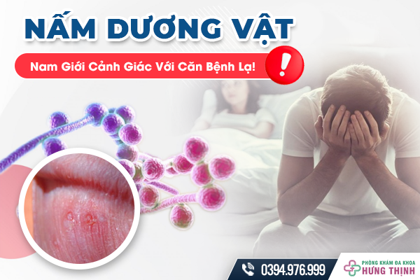 Nấm Dương Vật - Nam Giới Cảnh Giác Với Căn Bệnh Lạ!