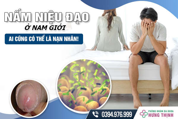 Nấm Niệu Đạo Ở Nam Giới - Ai Cũng Có Thể Là Nạn Nhân!