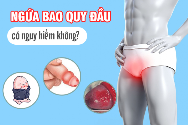 Ngứa Bao Quy Đầu Có Nguy Hiểm Không?