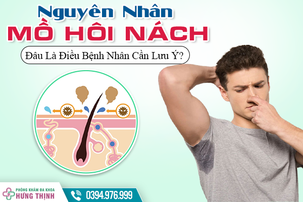 Nguyên Nhân Ra Mồ Hôi Nách - Đâu Là Điều Bệnh Nhân Cần Lưu Ý?