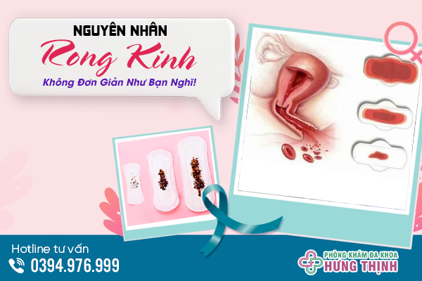 Nguyên Nhân Bị Rong Kinh Không Đơn Giản Như Bạn Nghĩ!