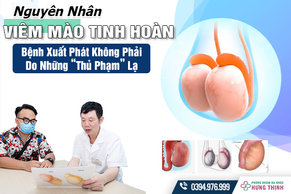 Nguyên Nhân Viêm Mào Tinh Hoàn: Bệnh Xuất Phát Không Phải Do Những “Thủ Phạm” Lạ