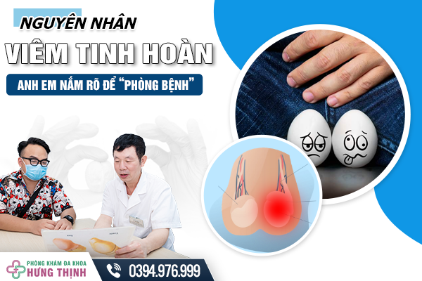 Nguyên Nhân Viêm Tinh Hoàn: Anh Em Nắm Rõ Để “Phòng Bệnh”