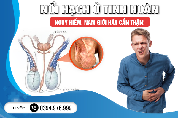 Nổi Hạch Ở Tinh Hoàn - Nguy Hiểm, Nam Giới Hãy Cẩn Thận!